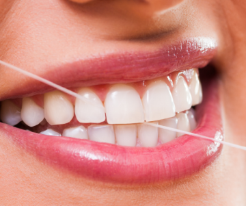 Cosmetic dentistry Gold Coast